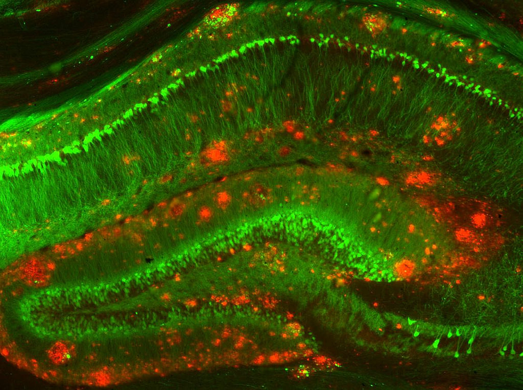In a mouse model of Alzheimer’s disease, amyloid beta clusters (red) build up among neurons (green) in a memory-related area of the brain. (NIH Image Gallery/Flickr)