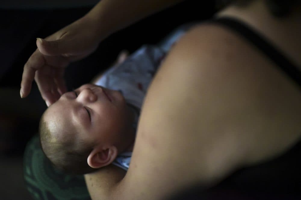 In this 2016 photo, Puerto Rico resident Michelle Flandez caresses her 2-month-old son, who was diagnosed with microcephaly linked to the mosquito-borne Zika virus. (Carlos Giusti/AP)