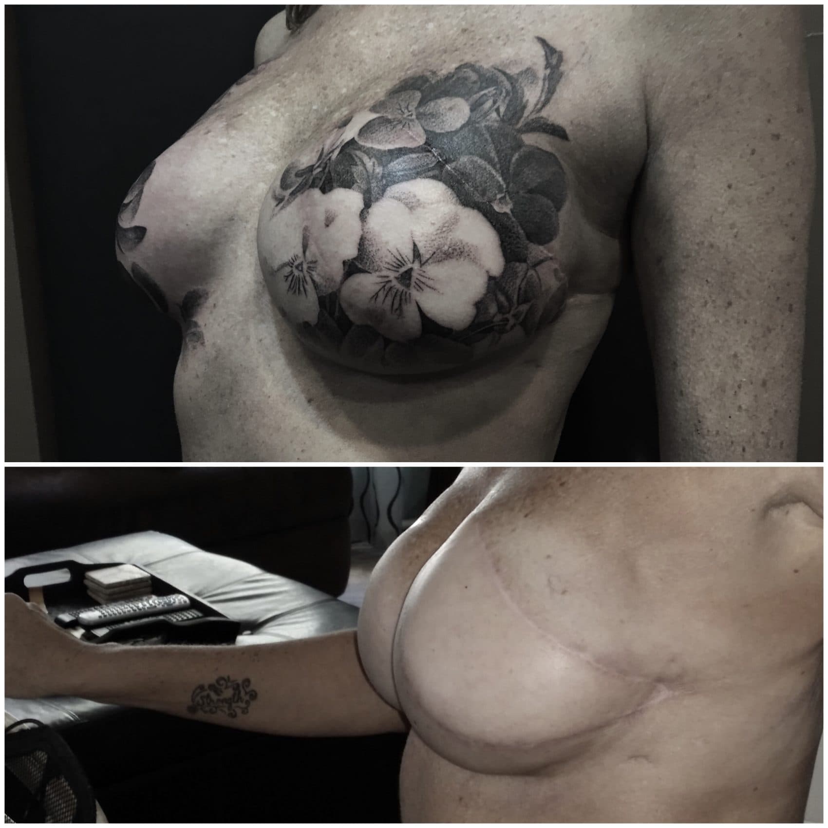 Reclaiming Their Beauty': Tattoo Artist Inks Exquisite Flowers Over  Mastectomy Scars | WBUR News