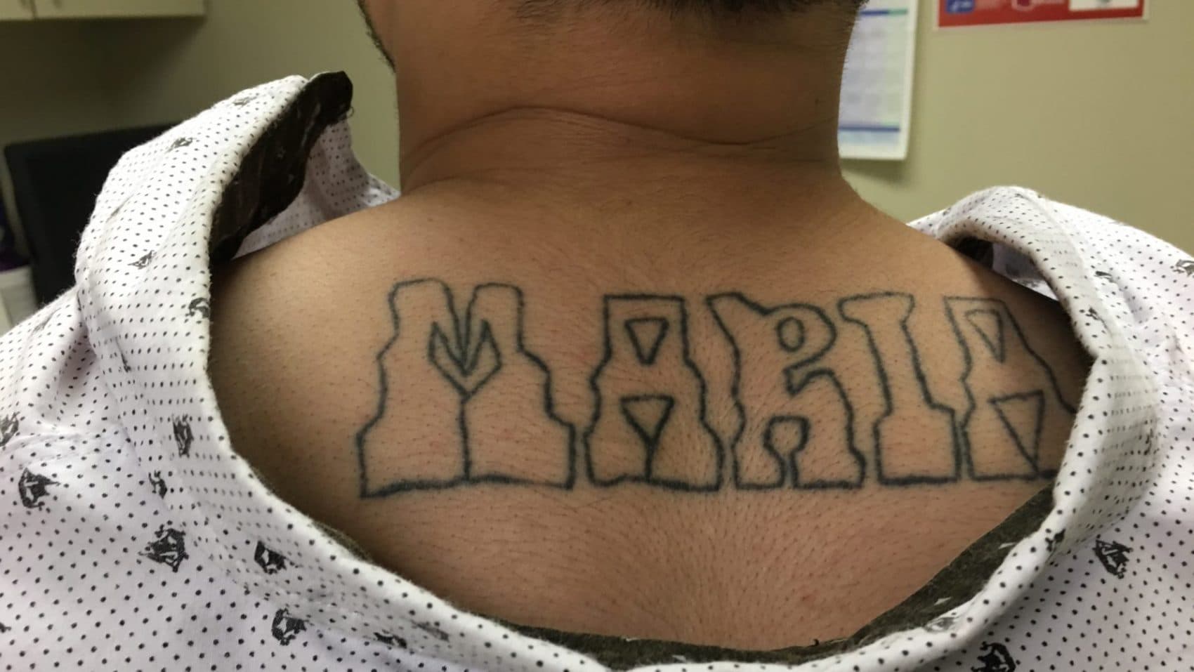 Former gang member Juan says he wants his tattoos gone because he wants to live a normal life and forget his past. (Armando Trull/WAMU)