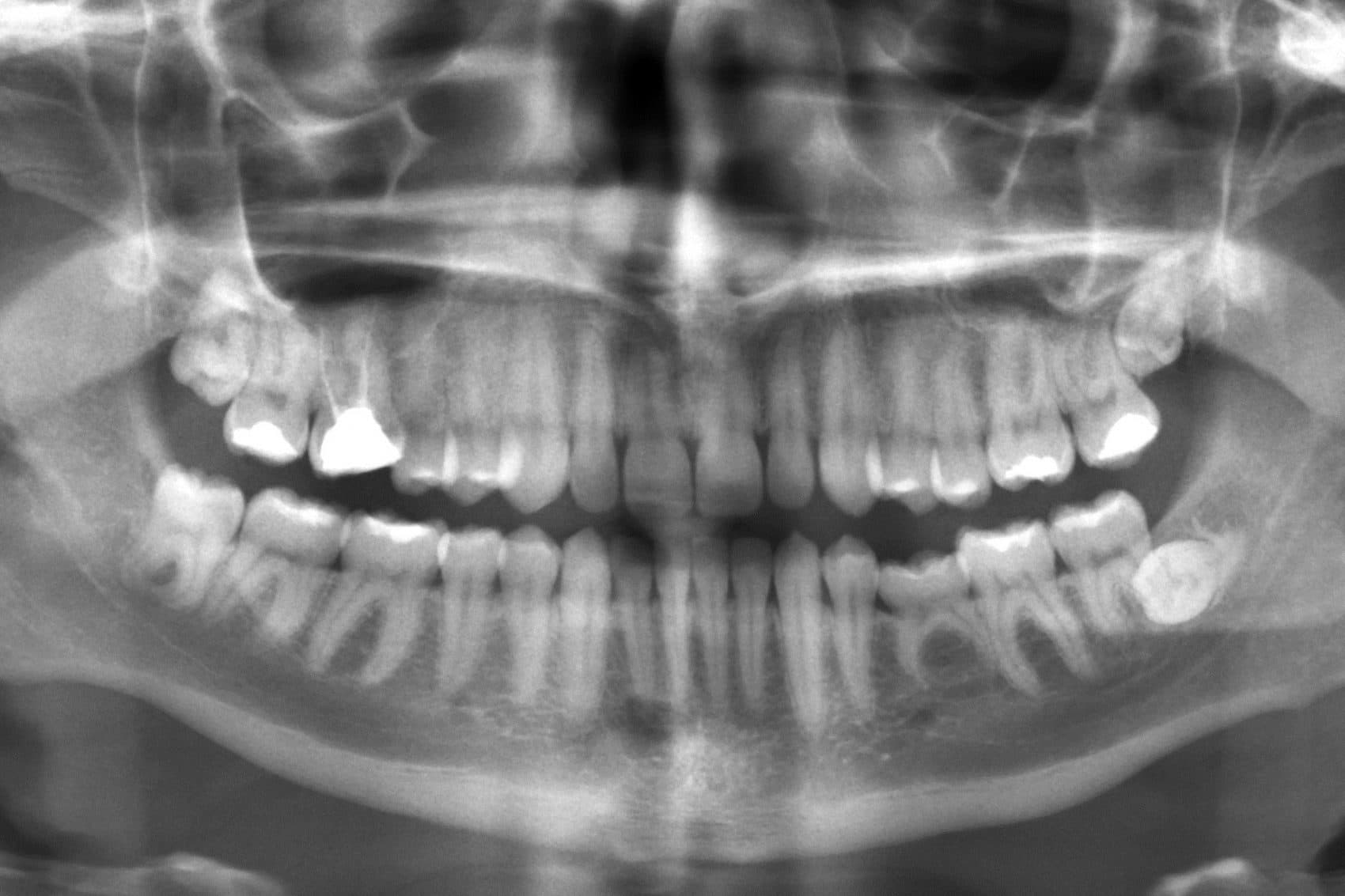 What do your teeth say about us? (Public Domain)