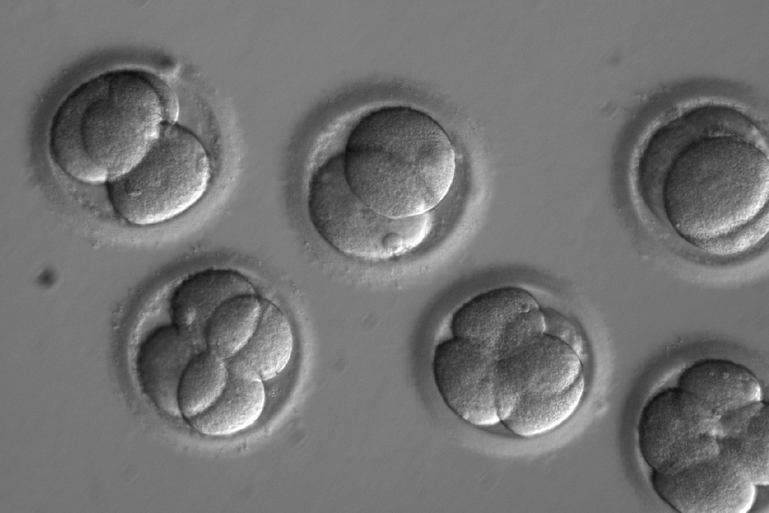 Human embryos grow in a laboratory for a few days after researchers used gene editing technology to successfully repair a heart disease-causing genetic mutation. (Oregon Health & Science University via AP)