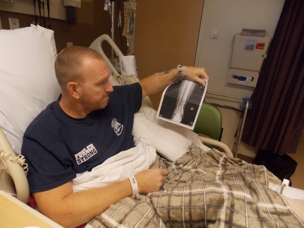 Kurt Fowler looks at an X-ray of his ankle as he sits in a hospital bed at Sunrise Hospital & Medical Center. Fowler, a firefighter from Arizona, got shot in the ankle and said he expects to be out of work for months as he recovers. (Anna Gorman/KHN)