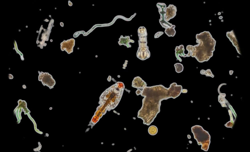 Plankton from a Maine tidal pool include a wide variety of microorganisms. The starship-shaped orange one in the middle is a copepod, a tiny crustacean. (Courtesy Scott Chimileski and Roberto Kolter)