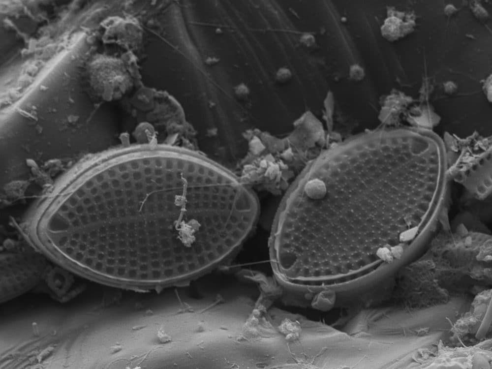 Single-celled diatoms are incredibly common in many environments. These came from a groove in a pebble about the size of a pea. An electron microscope shows them at about 20,000 times their actual size, making it easy to see the glass shell that envelopes them. (Courtesy Scott Chimileski.)