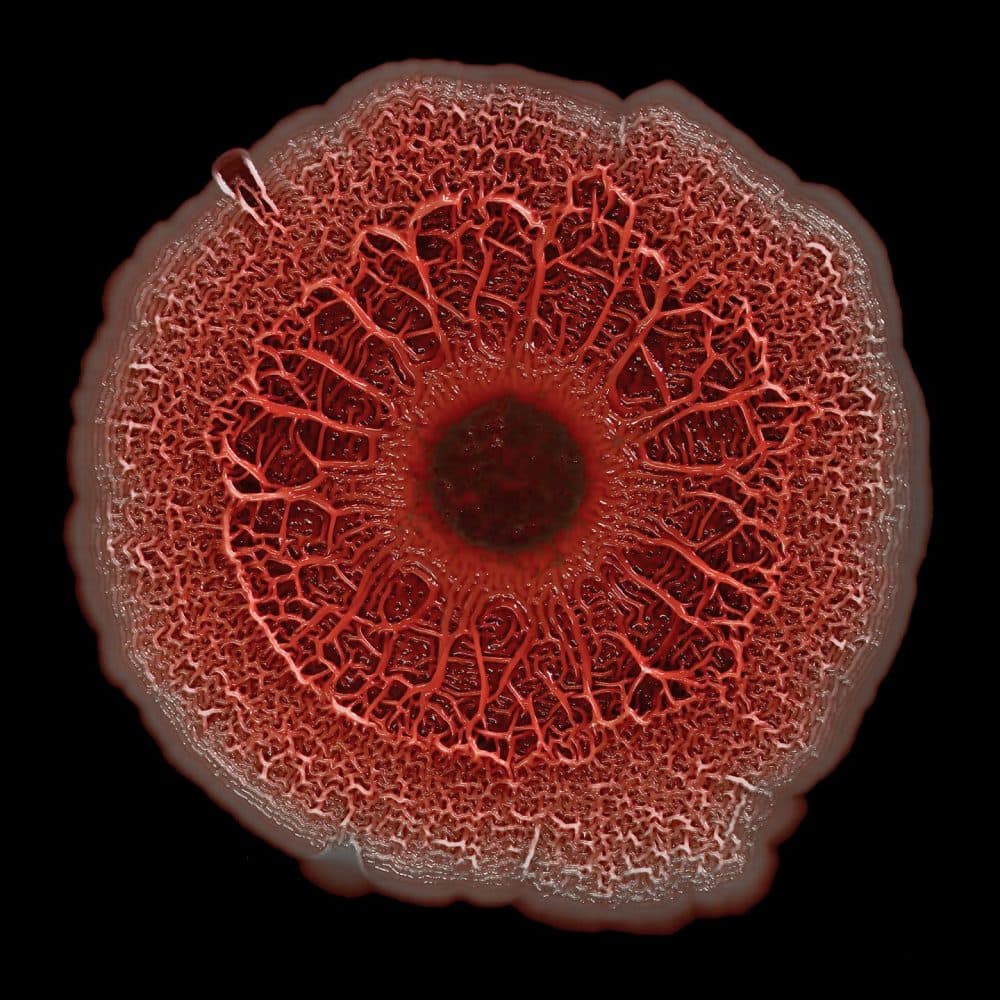 A biofilm, or colony of bacteria, can be beautiful but dangerous. This one is made up of bacteria that normally cause no harm, but can infect burn wounds or the lungs of cystic fibrosis patients. About the size of a dime, this biofilm developed in about a week. (Courtesy Scott Chimileski and Roberto Kolter)