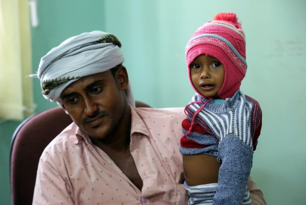 A Yemeni father carries his child, suspected of being infected with cholera, as he waits to be seen at a hospital in the Yemeni coastal city of Hodeidah on Nov. 5, 2017. (Abdo Hyder/AFP/Getty Images)