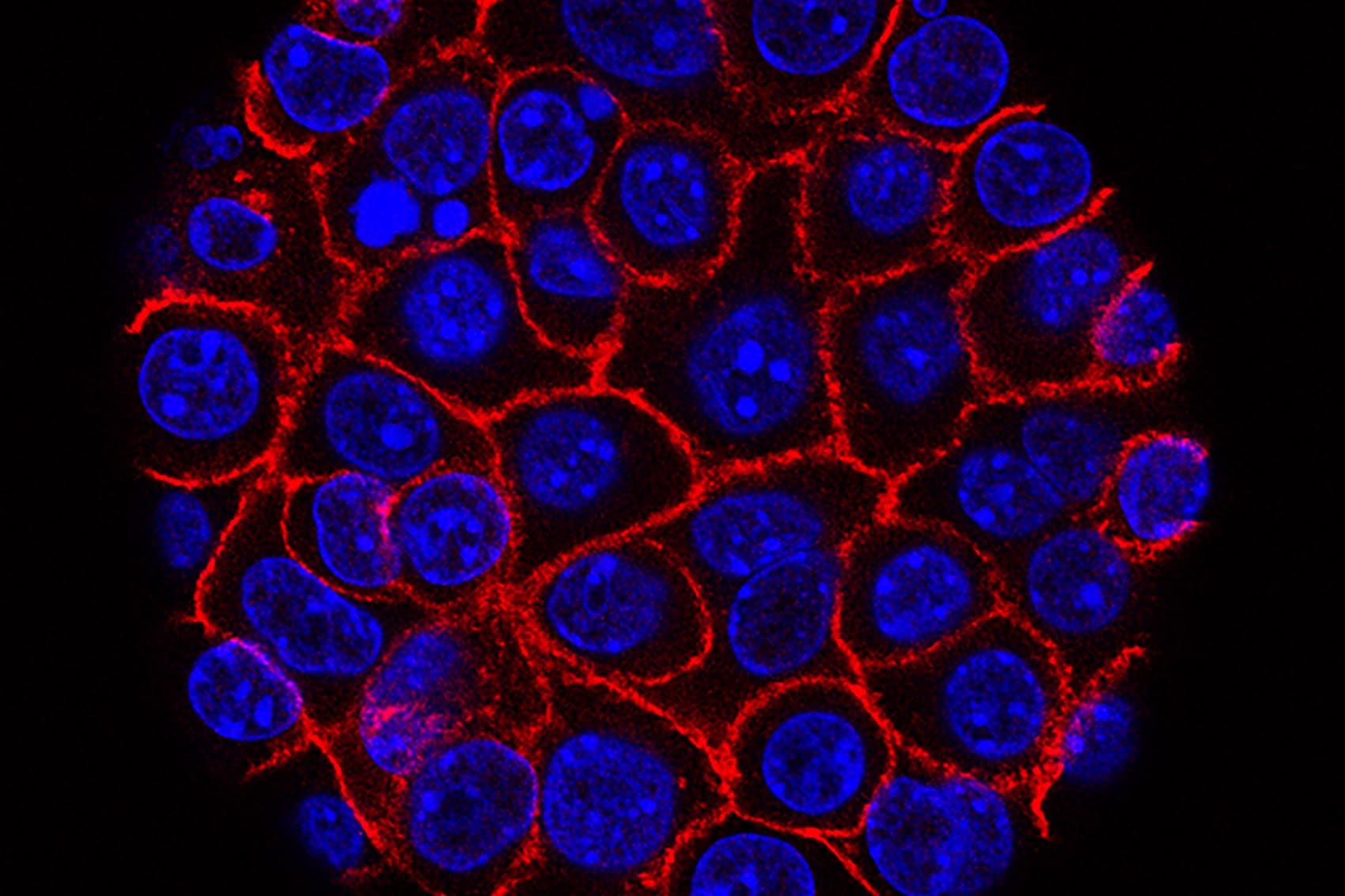 Pancreatic cancer cells (nuclei in blue) growing as a sphere encased in membranes (red) (Courtesy of National Institutes of Health via Flickr)