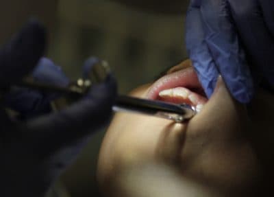 Dental Sedation Kills 4-Year-Old Who Might Have Been Saved By A Toothbrush