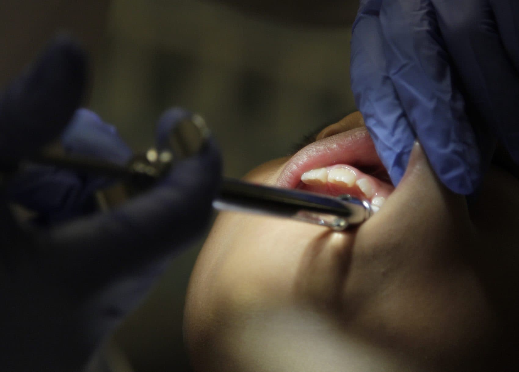 A dentist works on a child in the Christina's Smile clinic at Norton Middle School Tuesday, May 27, 2014, in Columbus, Ohio. (Jay LaPrete/AP)