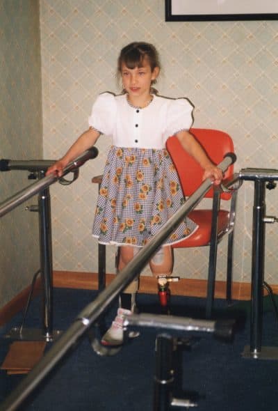 Oksana's first steps, in 1998, after her first leg amputation. (Courtesy MoSwo PR)