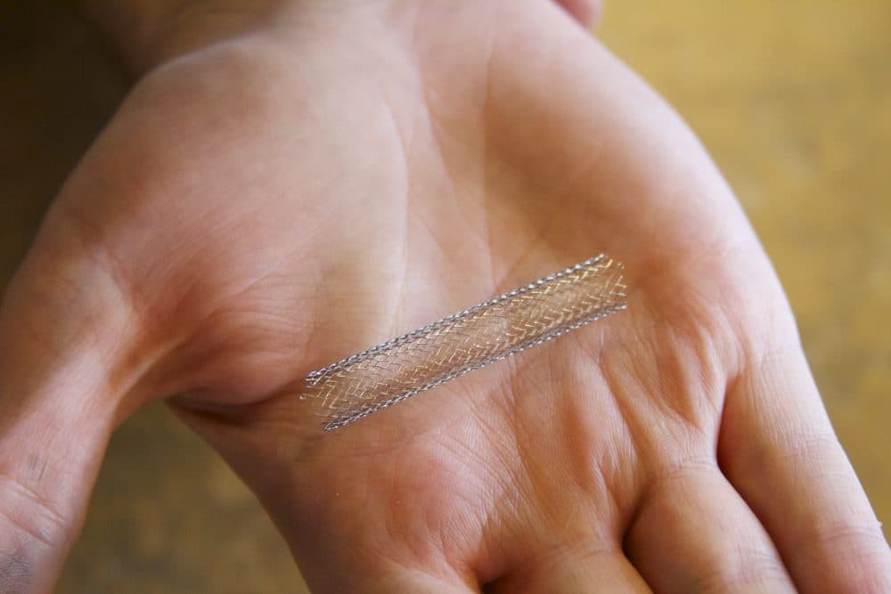 A stent held in the palm of the hand (Lenore Edman/Flickr)