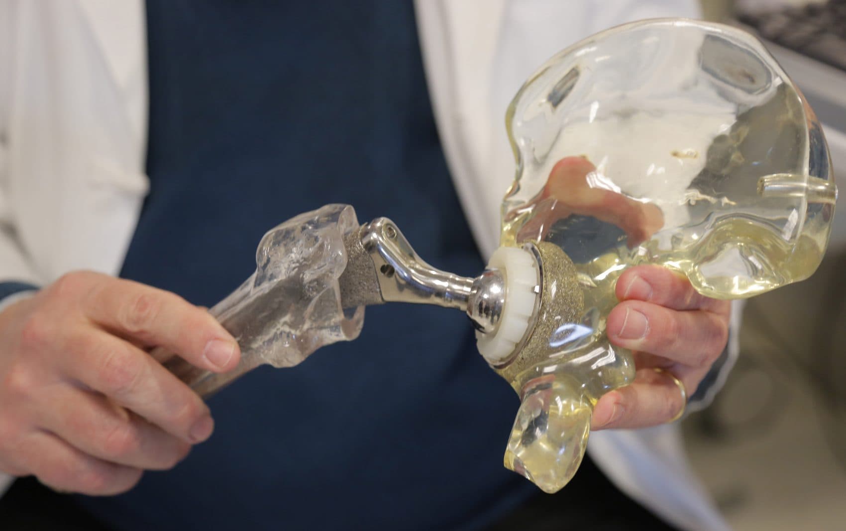 In this 2014 file photo, Dr. Joshua Jacobs, orthopedics surgery chief at Rush University Medical Center and president of the American Academy of Orthopaedic Surgeons in Chicago, holds a model of a cementless hip replacement. (M. Spencer Green/AP)