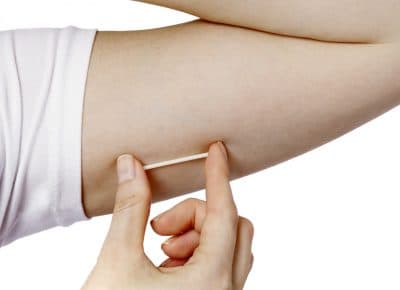 A model holds a Nexplanon birth control hormonal implant. (Merck/AP)