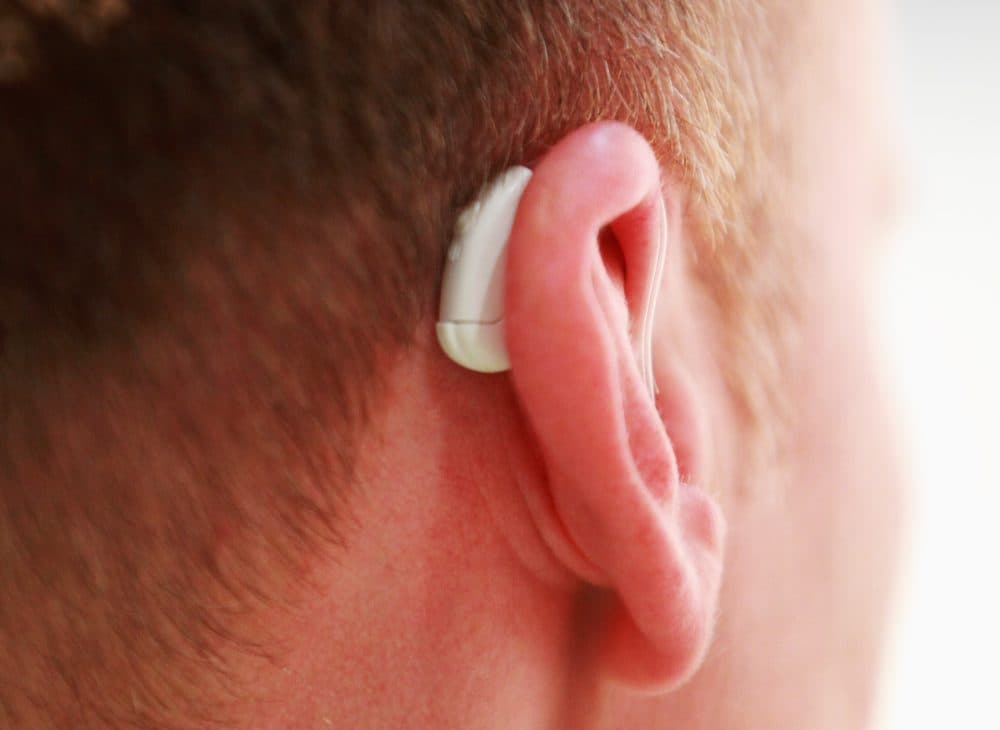 Hearing aids are expensive, and they're not covered by Medicare or many private insurance plans. (Joern Pollex/Getty Images)