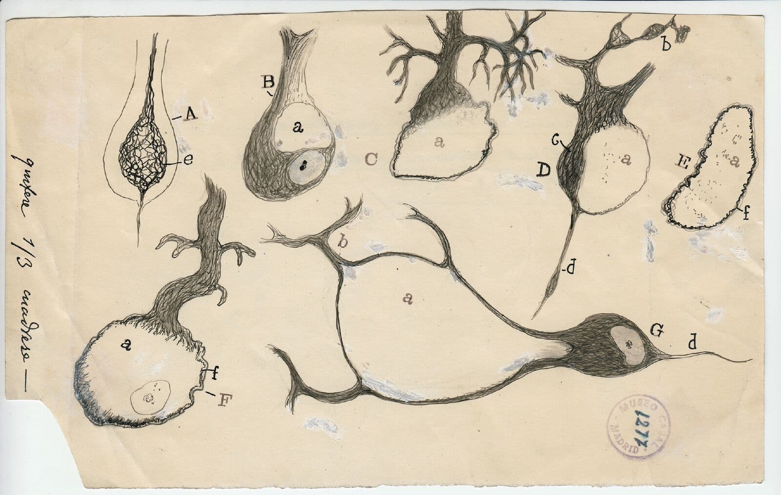 Santiago Ramón y Cajal ink and pencil drawing of injured Purkinje neurons, created in 1914. (Courtesy of Instituto Cajal)