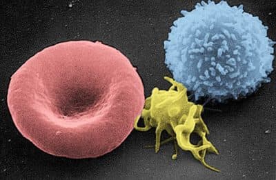 Next Era For Biotech: Designer Cells To Attack Diseases