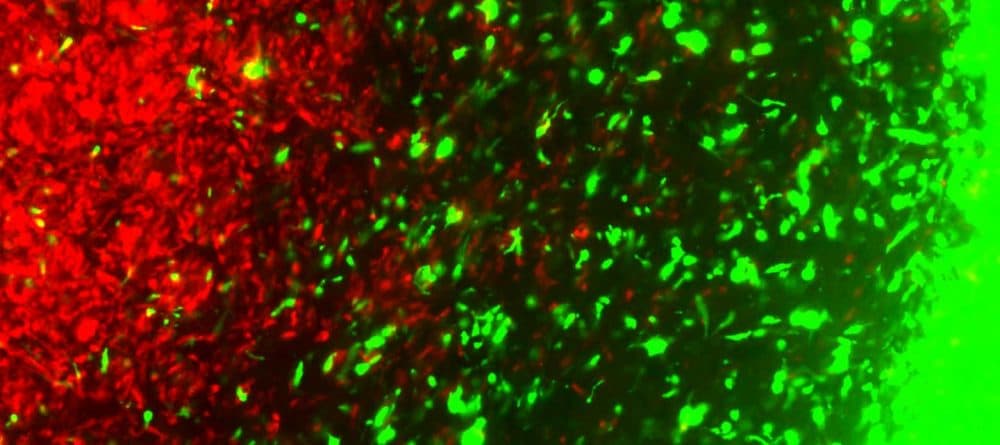 In this image, CRISPR-engineered therapeutic cancer cells (green) track primary cancer cells (red) in the brain. (Khalid Shah lab/CSTI)