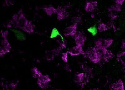 Newly identified rare pulmonary ionocytes (green) dot the landscape of ciliated cells (magenta) of the mouse lung airway lining. (Courtesy of Broad Institute)