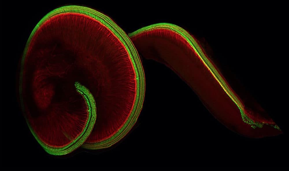 The snail shell-shaped part of the inner ear that houses hair cells (Courtesy of Holt Lab)