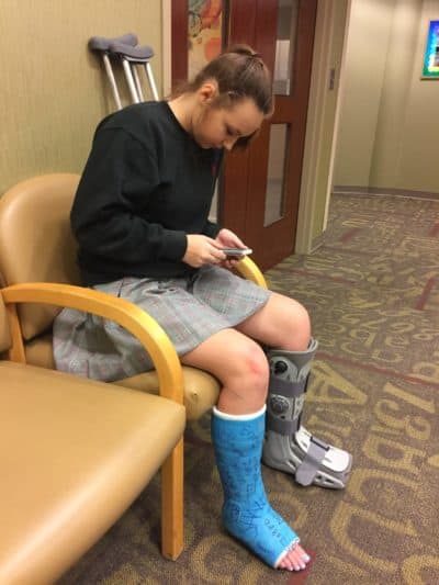 Alex after having two ankle surgeries. (Courtesy Richard Blackwell)
