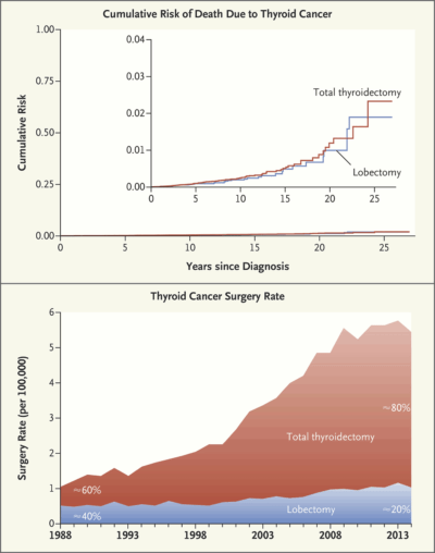 Total thyroidectomies have continued to rise. (Courtesy of the New England Journal of Medicine)