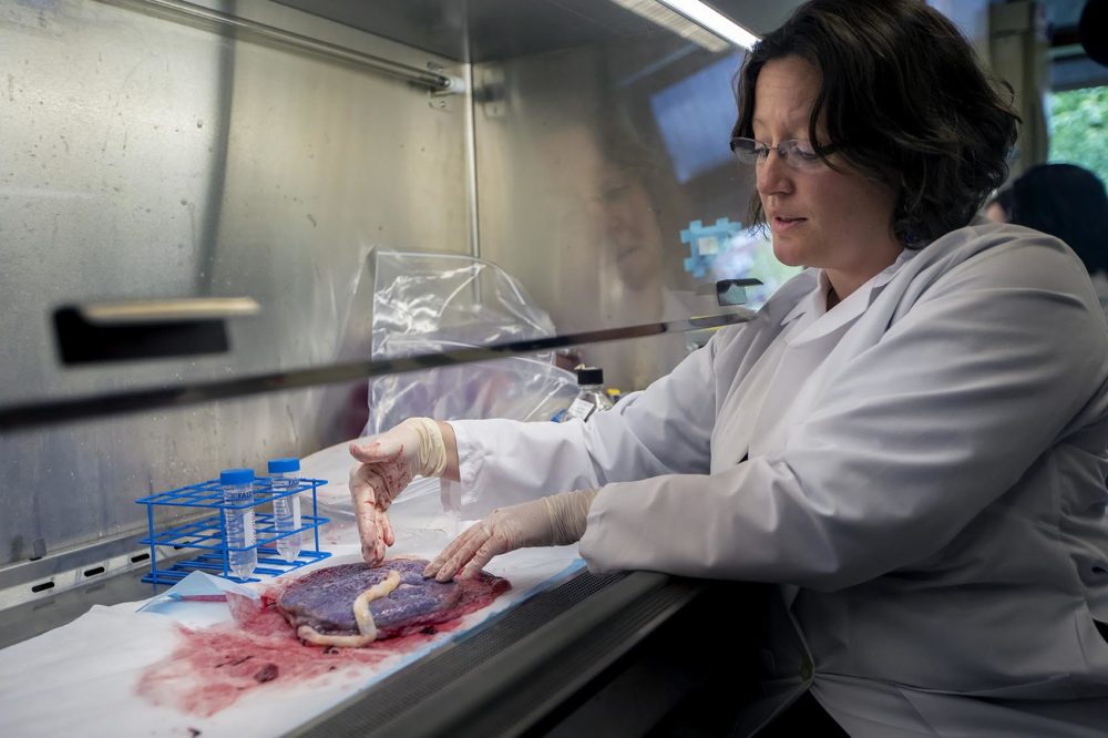 Tamara Tilburgs examines a placenta from a healthy pregnancy that went full term. (Jesse Costa/WBUR)