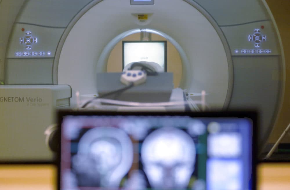 A brain-scanning MRI machine. Researchers at Boston University have worked on a new device to enhance MRI signals and cut down on MRI scan times. (Keith Srakocic/AP)