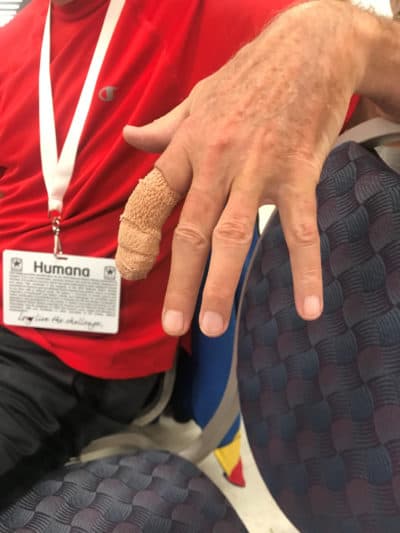 Nine weeks before the National Senior Games, Jay cut off a finger. (Courtesy Laura Arenschield)