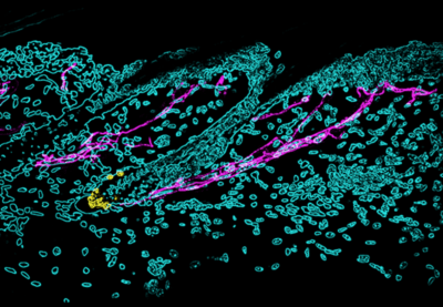 Extensive nerve cells (magenta) around stem cells (yellow) that generate hair pigment cells. Harvard researchers have found that acute stress hyper-activates the sympathetic nervous system, which rapidly depletes the stem cells and leads to hair graying. (Image: Hsu Laboratory, Harvard University.)
