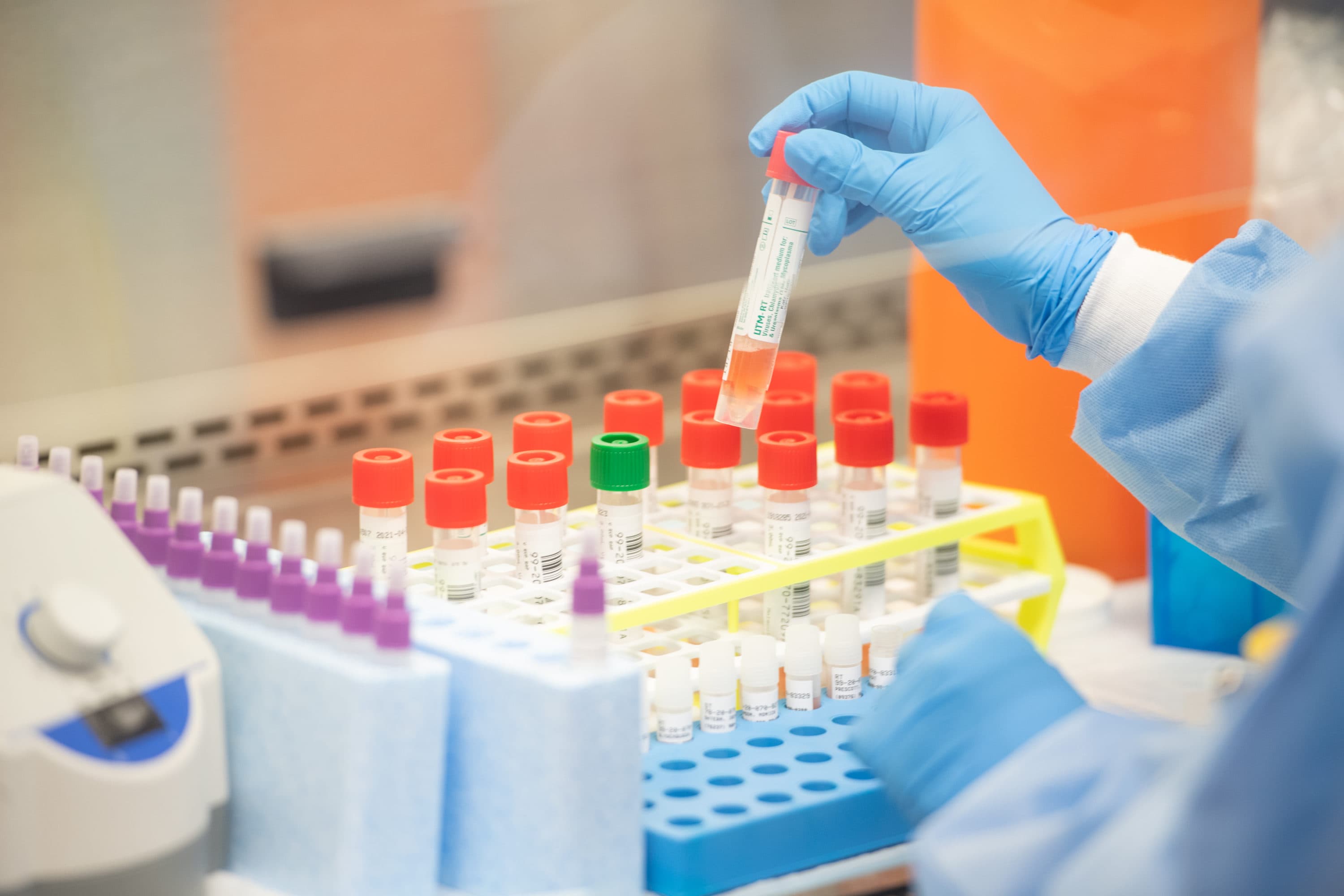 A lab technician begins semi-automated testing for COVID-19 at Northwell Health Labs on March 11, 2020 in Lake Success, New York. (Andrew Theodorakis/Getty Images)