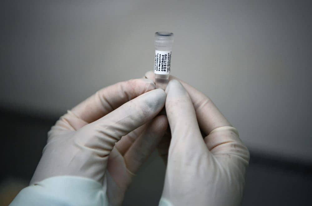 An analyst at Fiocruz laboratory, a public health research institute, in Rio de Janeiro holds a sample of mucus to be tested for COVID-19, on March 11, 2020. (Carl de Souza/AFP via Getty Images)