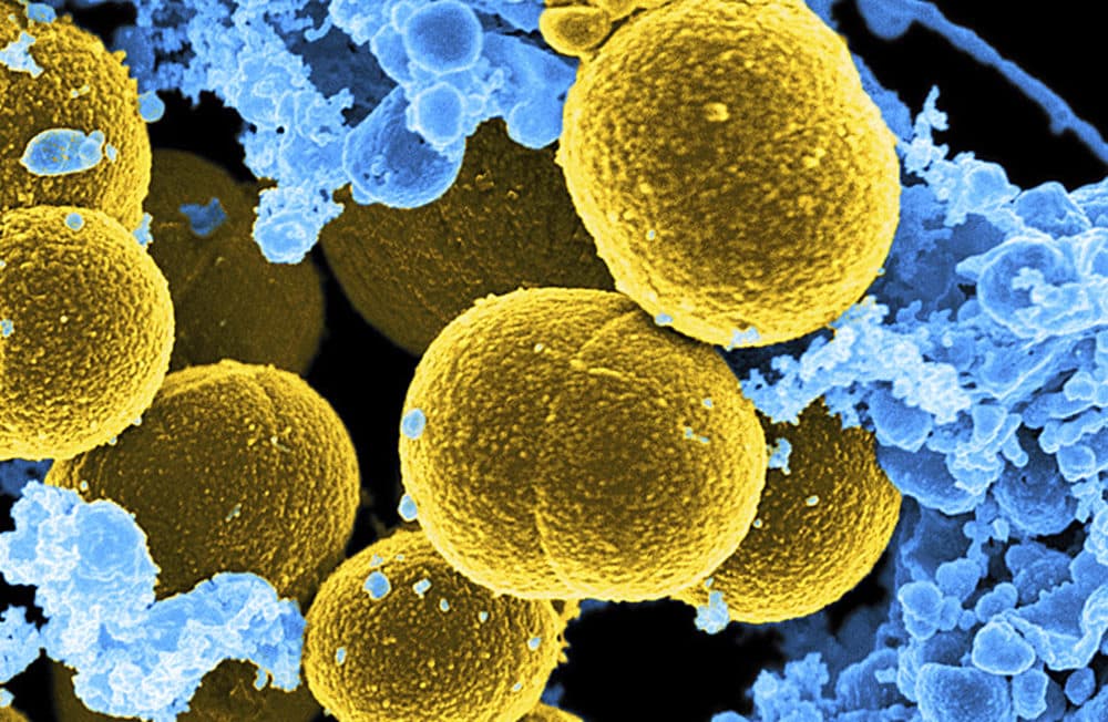 This digitally colorized microscope image provided by the National Institute of Allergy and Infectious Diseases shows Staphylococcus aureus bacteria in yellow. (National Institute of Allergy and Infectious Diseases via AP)