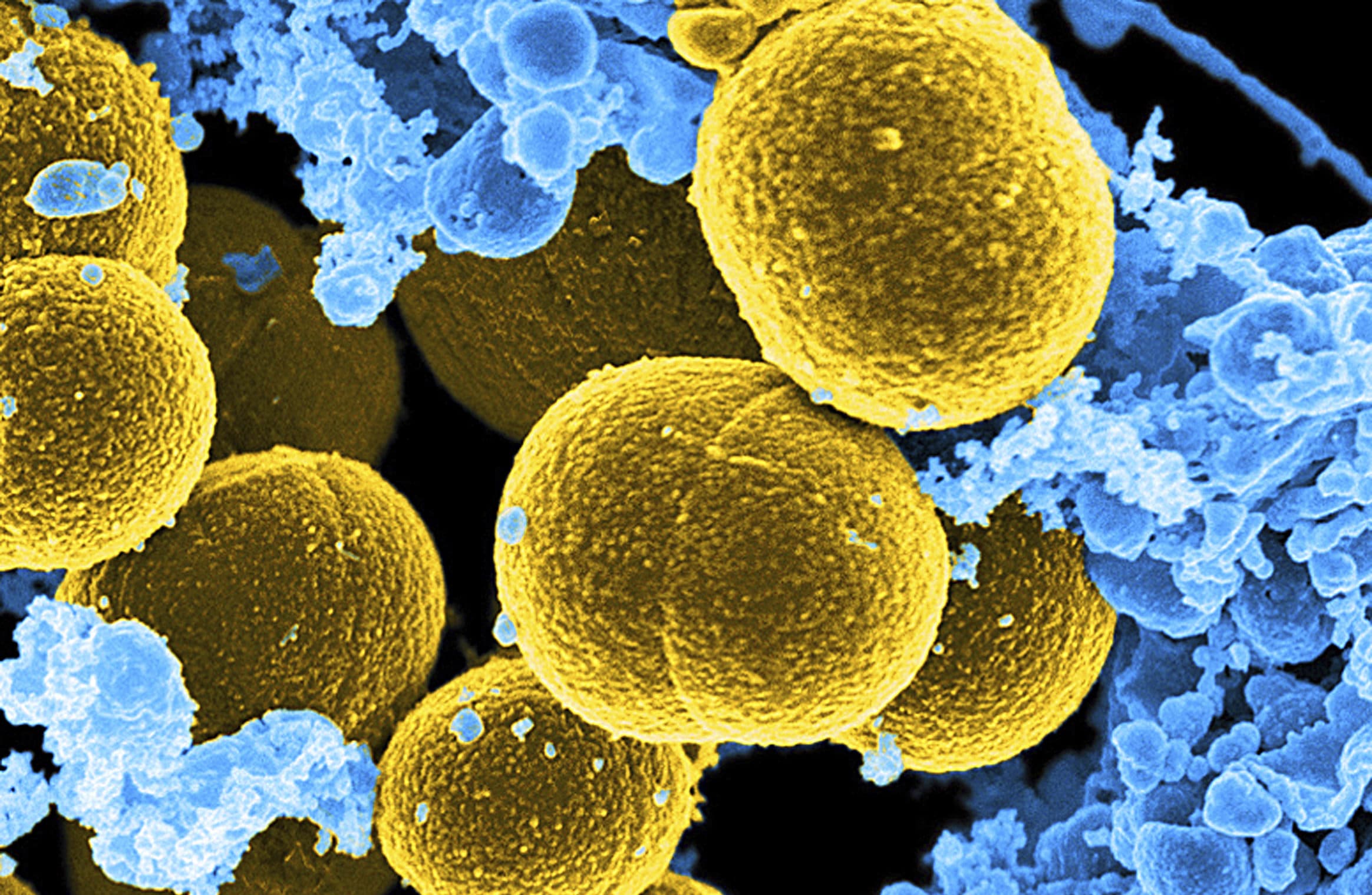 How Bacteria Could Affect Outcomes Of COVID-19 Patients