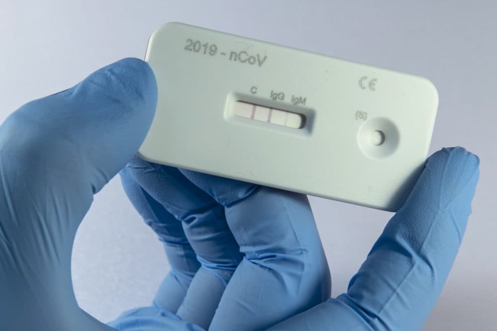 A scientist presents an antibody test for coronavirus in a laboratory of the Leibniz Institute of Photonic Technology (Leibniz IPHT) at the InfectoGnostics research campus in Jena, Germany. (Jens Meyer/AP)