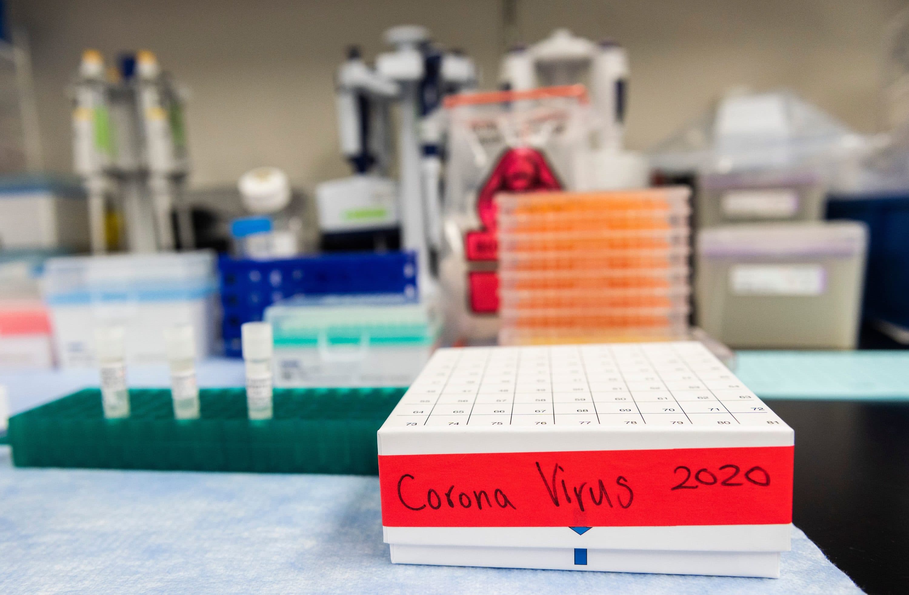Three potential coronavirus, COVID-19, vaccines are kept in a tray at Novavax labs in Rockville, Maryland on March 20, 2020, one of the labs developing a vaccine for the coronavirus, COVID-19. (ANDREW CABALLERO-REYNOLDS/AFP via Getty Images)