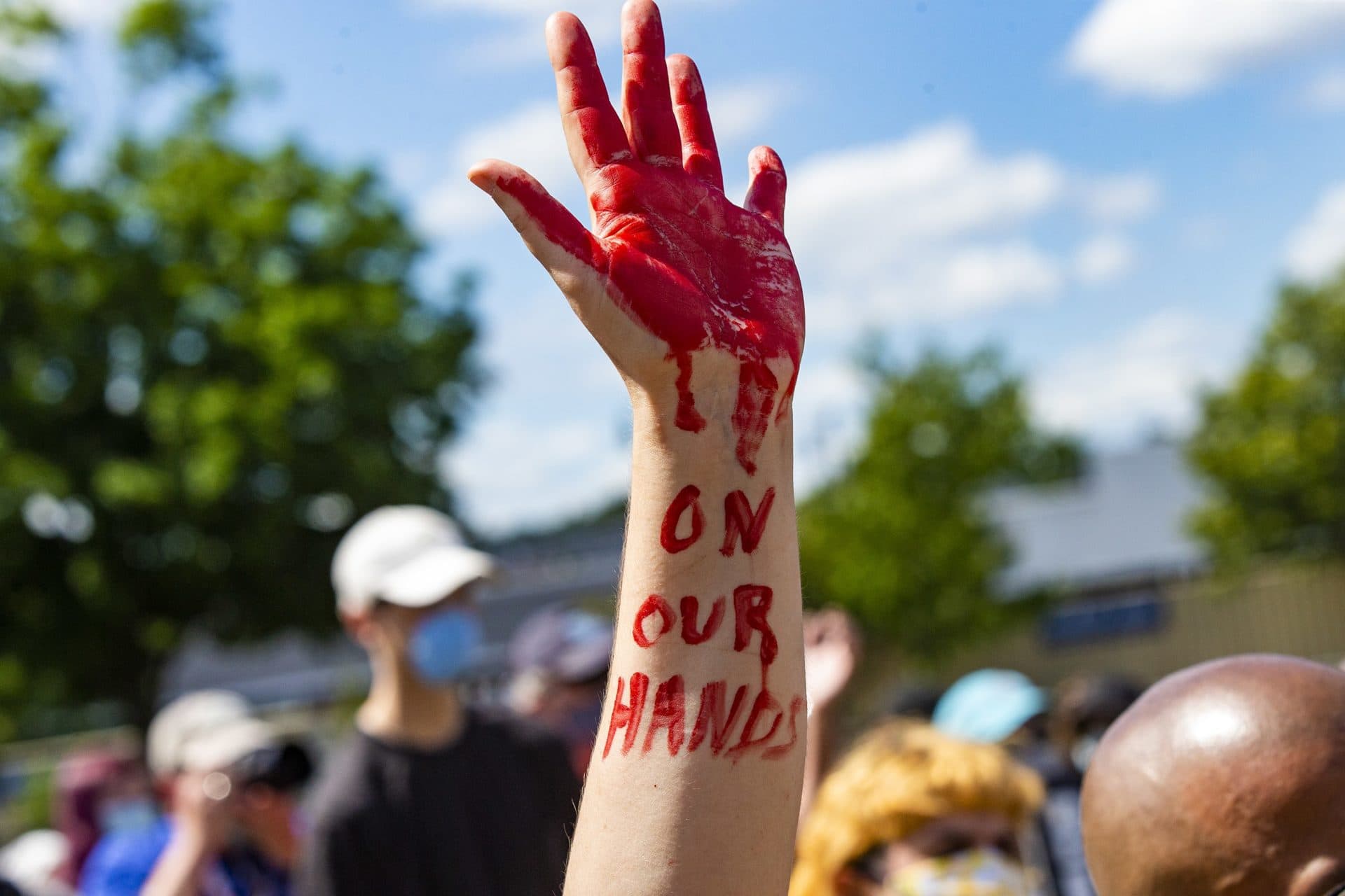 A rally participant with the “[Blood] on our hands” written on her arm at the Black Lives Matter rally in Fields Corner. (Jesse Costa/WBUR)