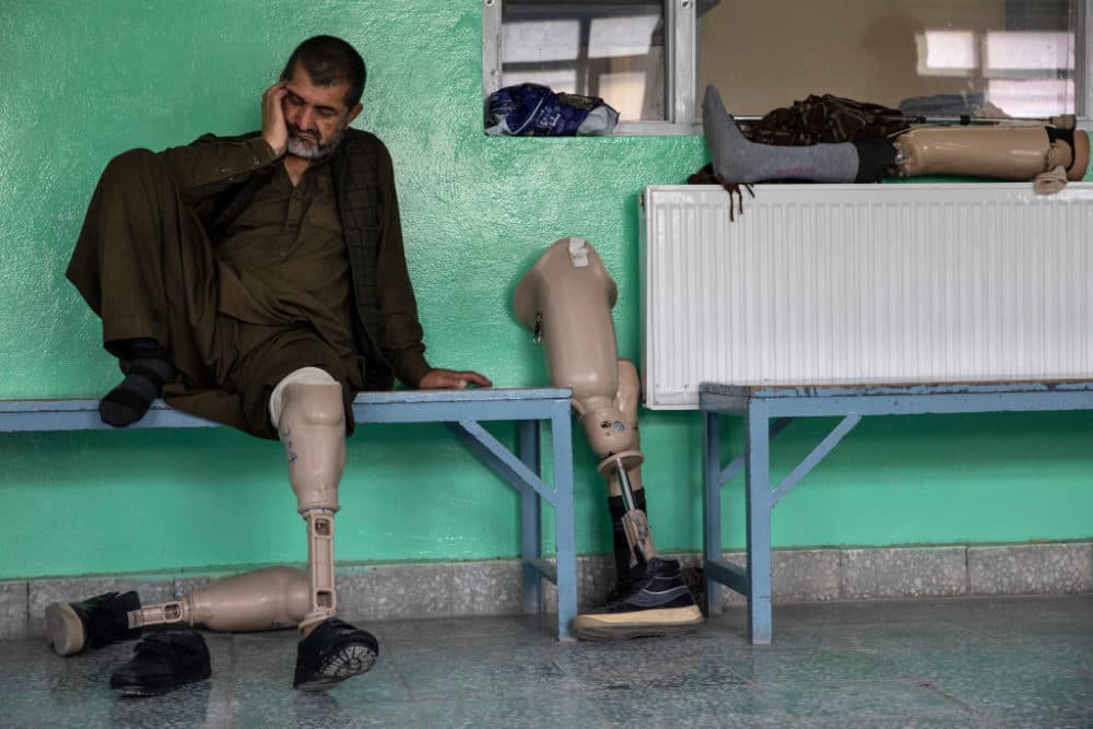 An Afghan man rests after walking on his new prosthetic leg at the ICRC Orthopedic Center on September 30, 2019 in Kabul, Afghanistan. The war in Afghanistan, now in its 18th year, continues to inflict significant harm on the country’s civilian population. (Paula Bronstein/Getty Images )
