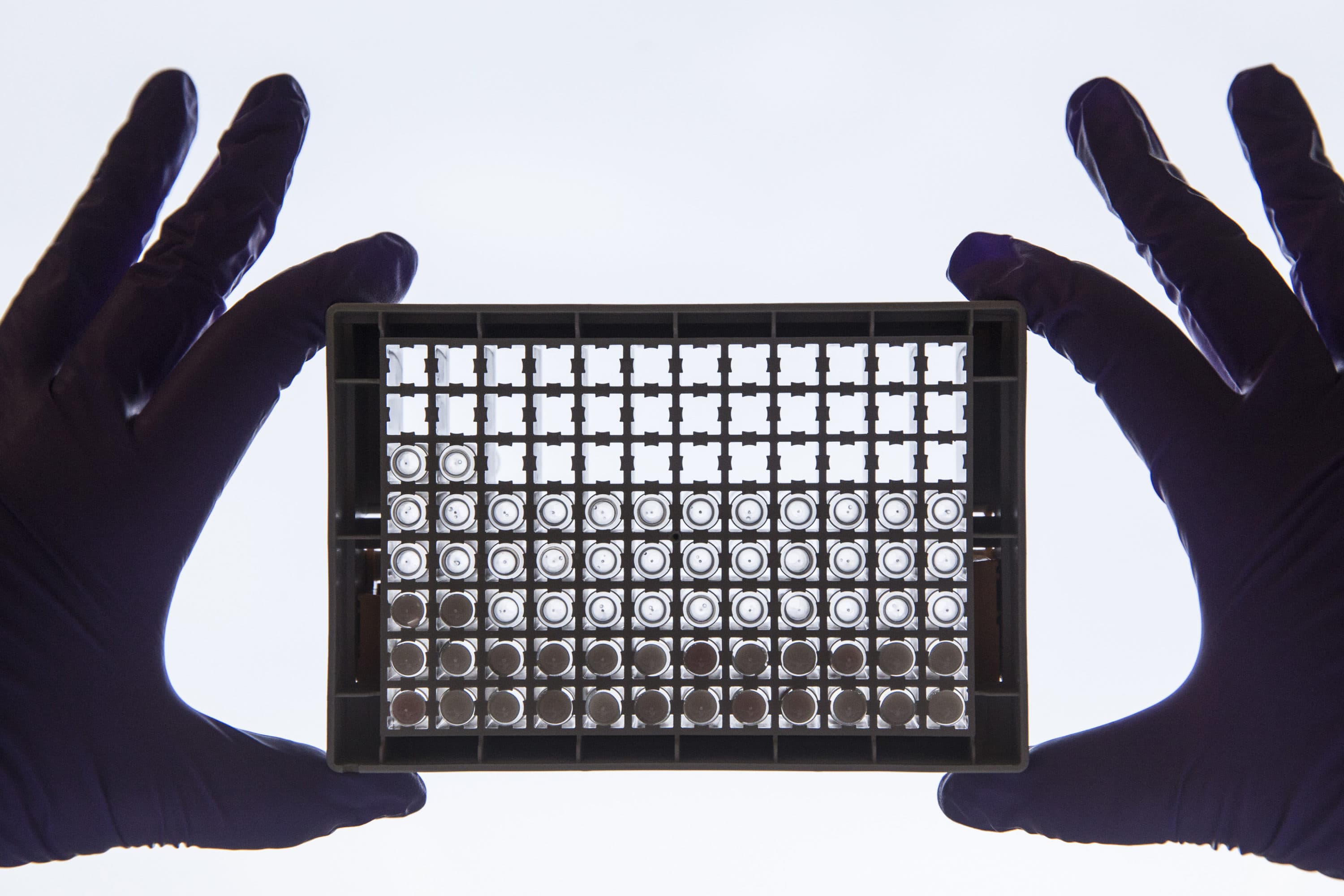 A scientist comparing treated and untreated cancer cells in a 96-well plate. (Dan Kitwood/Getty Images/Cancer Research UK)
