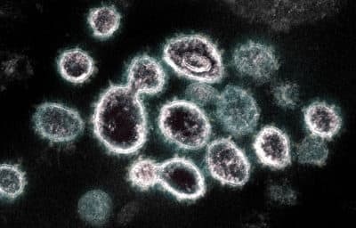 The Coronavirus May Never Go Away. But This Perpetual Pandemic Could Still Fizzle Out