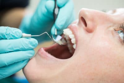 Fear Of The Dentist — It's Real. Tell Us Why You Dread Going To Your Appointment