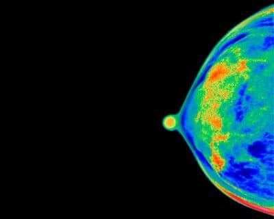 What to say when someone you love gets cancer