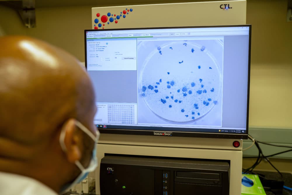 A researcher at the Africa Health Research Institute in Durban, South Africa, works on the omicron variant of the COVID-19 virus on Dec. 15, 2021. (Jerome Delay/AP)