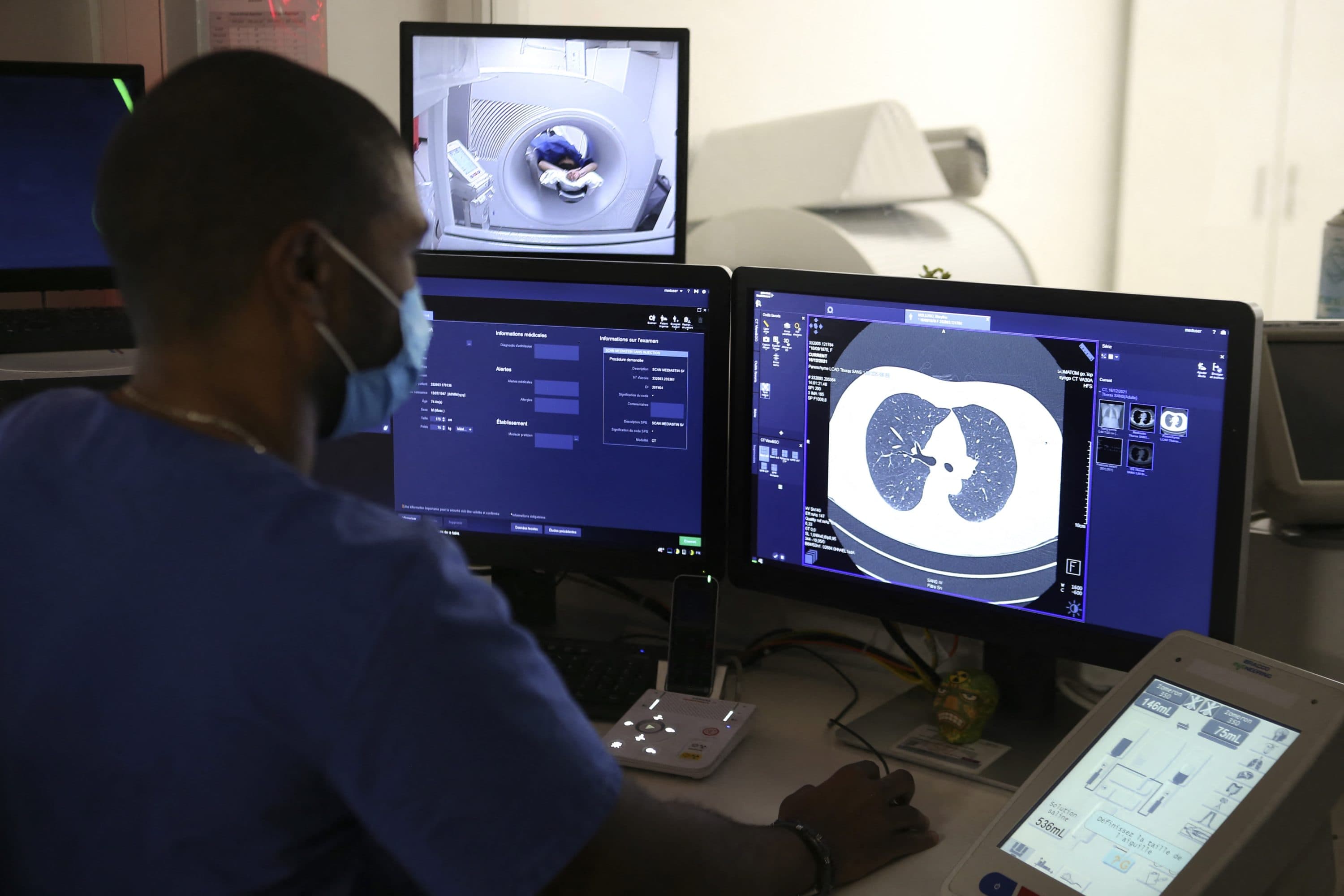 The pandemic caused delays in routine cancer screenings — and missed cancer diagnoses