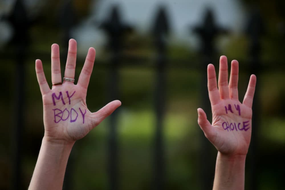 A protester wrote my body, my choice, on their hands during a protest at the Massachusetts State House in Boston, Mass. on May 03, 2022. (Craig F. Walker/The Boston Globe via Getty Images)