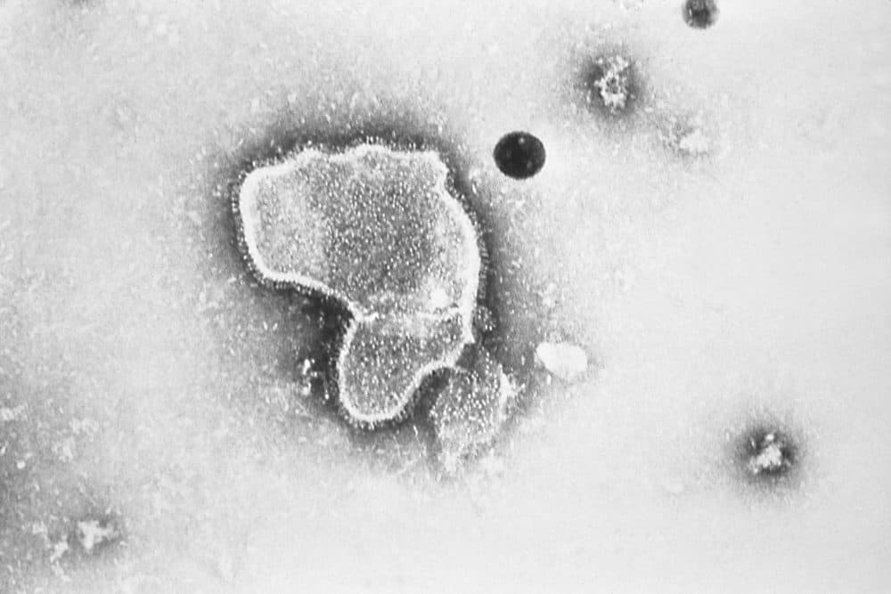 This 1981 photo provided by the Centers for Disease Control and Prevention (CDC) shows an electron micrograph of Respiratory Syncytial Virus, also known as RSV. (CDC via AP, File)