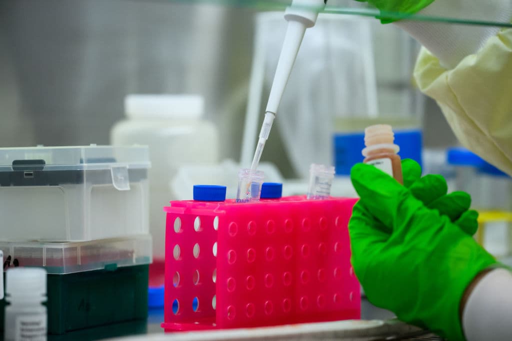 Molecular biologist Emanuel Wyler examines wastewater samples for pathogens, including coronavirus, in a laboratory in Berlin, Germany. (Bernd von Jutrczenka/picture alliance via Getty Images)