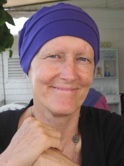 The author during her treatment for inflammatory breast cancer (IBC) in 2011. (Courtesy Meg Senuta)