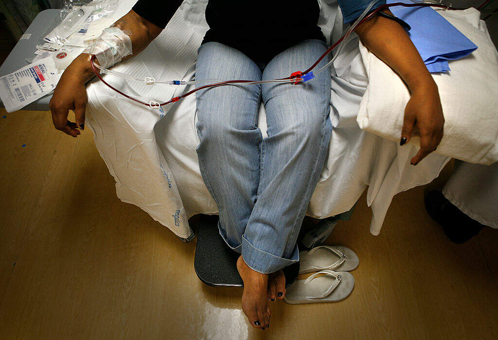 Marguerita, an undocumented citizen from Mexico, is connected to a dialysis machine at the St. Joseph Hospital Renal Center in Orange, Calif., where she receives dialysis three times a week. (Mark Boster/Getty Images)