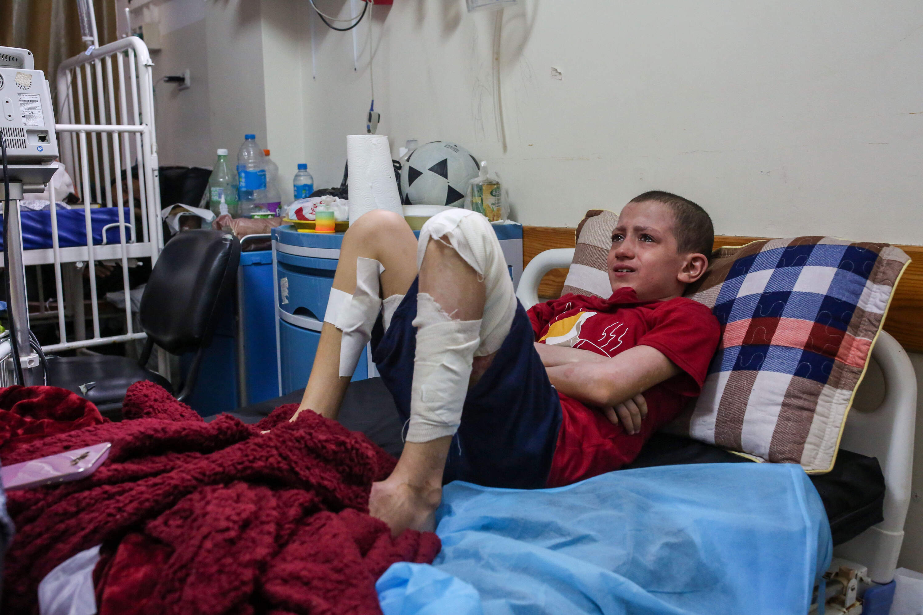 Bombs burned this young boy's legs. (Samar Abu Elouf/New York Times)